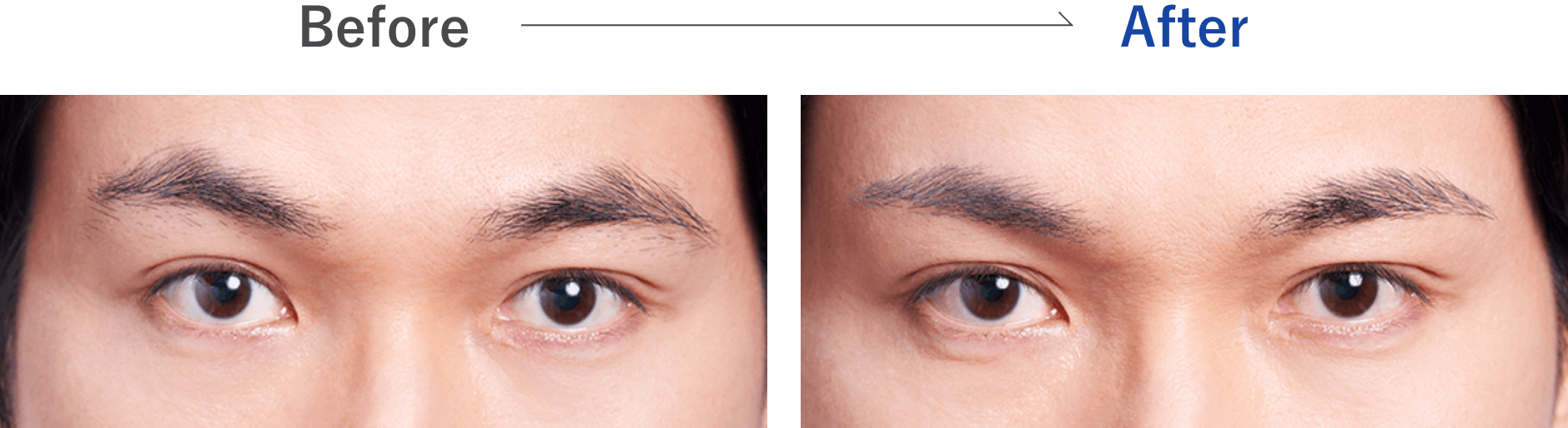 Before／After