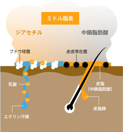 メカニズム